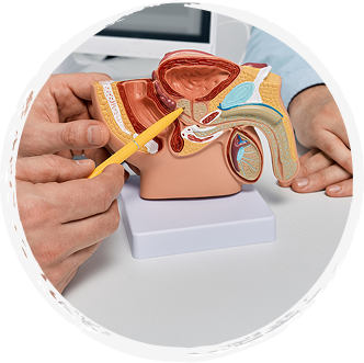 Prostate Cancer